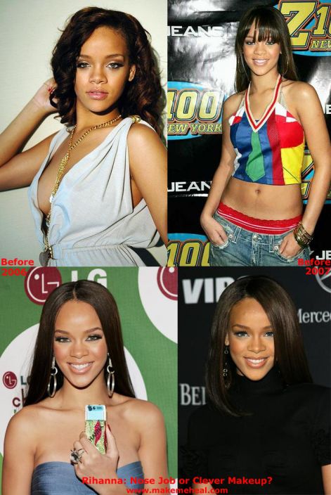 rihanna-nose-job.jpg